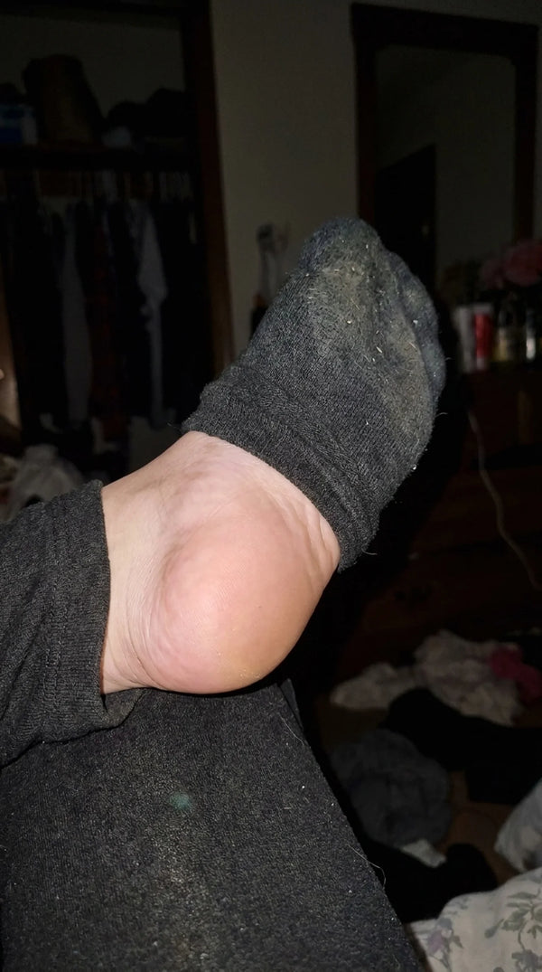 Thick skin peeling away fast