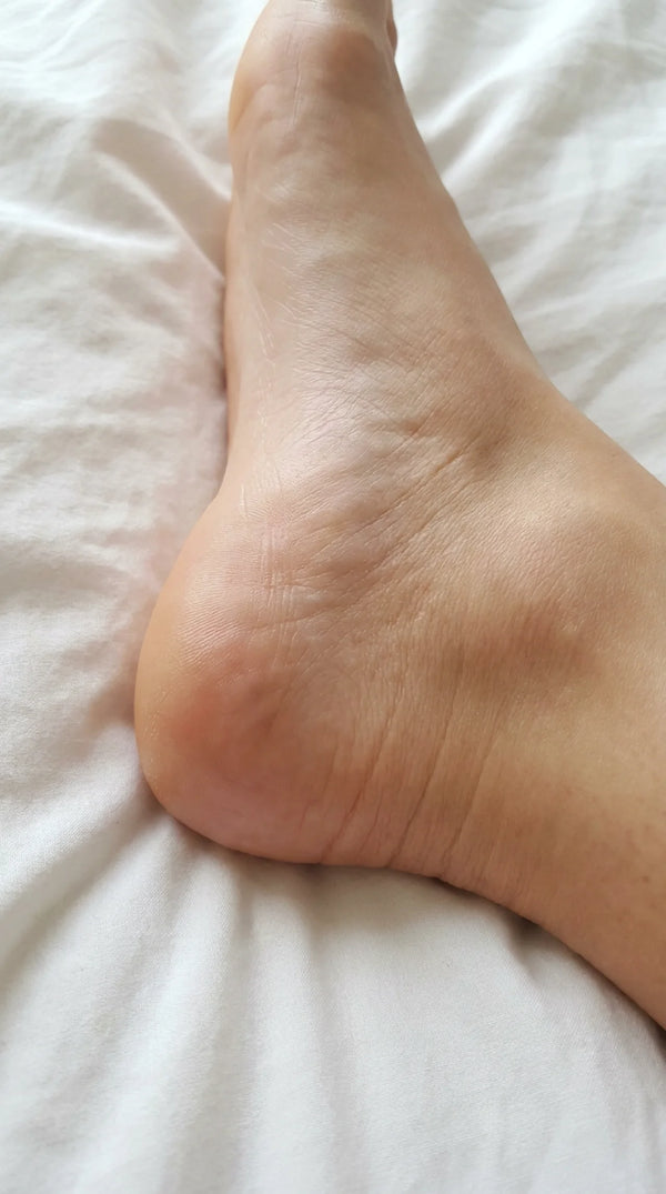 Completely erased my dry calluses!